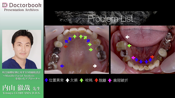 Occlusionの真髄～色々な咬合と機能～ | Doctorbook academy